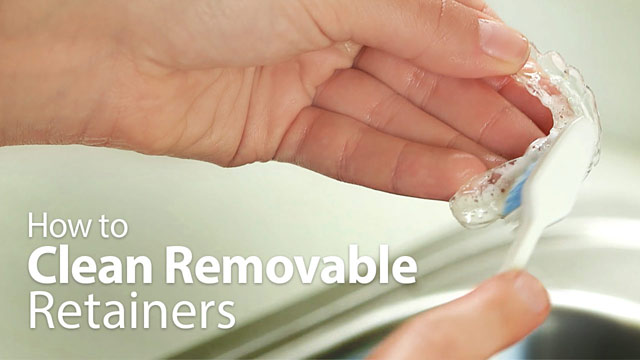 How to Clean Removable Retainers Video