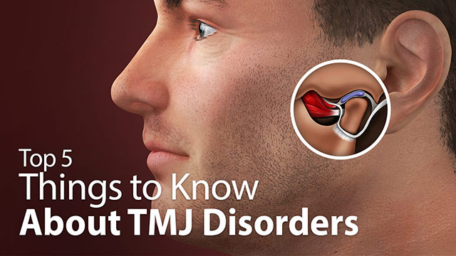 Top 5 Things to Know About TMJ Disorders Video