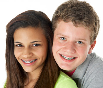 Types of Braces, Connor Orthodontics