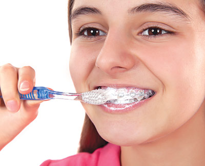 cleaning teeth wearing braces