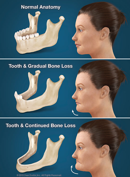 do you lose your canine teeth