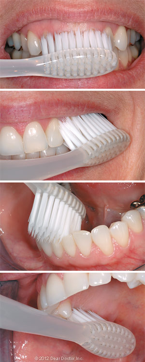 Image displaying how to brush your teeth.