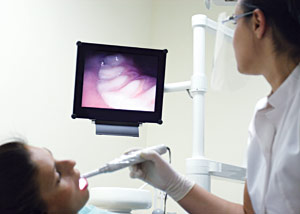 Intra-Oral Camera.