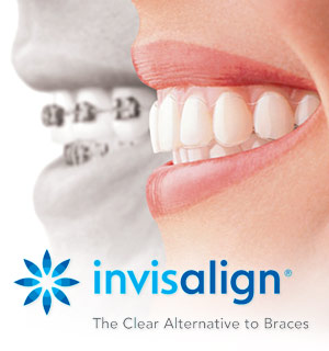 side by side images of mouth with braces and mouth with Invisalign, Royal Palm Beach, FL