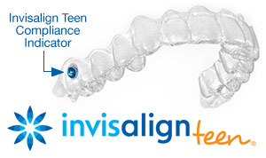 Madisonville Invisalign teen.