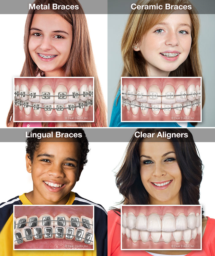 Orthodontics, Fulmer Orthodontics