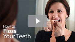 How to Floss Your Teeth to fight periodontal disease, Palmdale CA