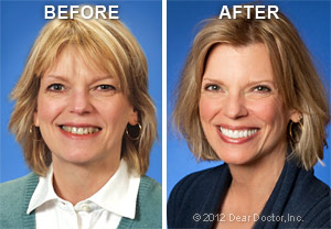 Image showing the before and after results of Cosmetic dentistry treatments