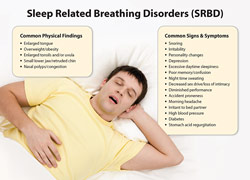 Sleep Related Breathing Disorders.