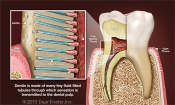 Blowup of Dentin.