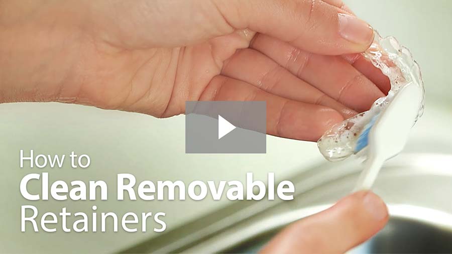 How to Clean Removable Retainers video