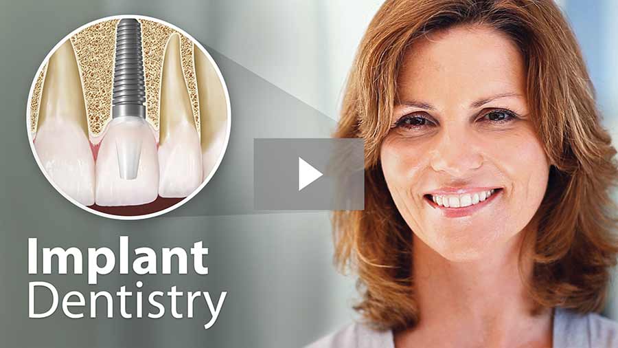 Implant dentistry video
