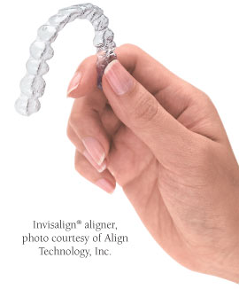 Clear Orthodontic Aligners