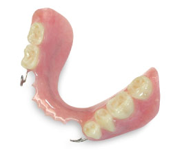 removable partial denture
