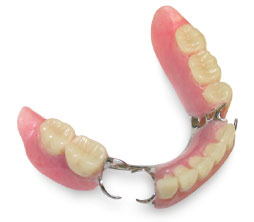 removable partial denture