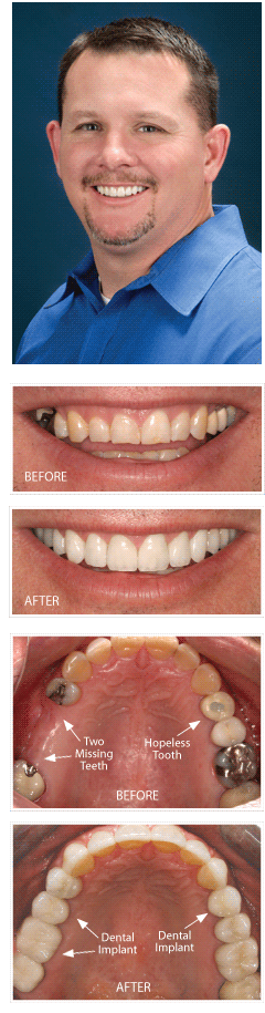 Smile Makeover Contest Winner