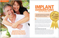 Implant overdentures - dear doctor magazine