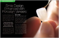 Dental Education East Aurora - Porcelain Veneers Dear Doctor Magazine