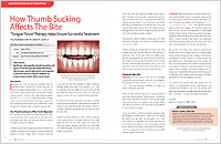 How Thumb Sucking Affects The Bite - Dear Doctor Magazine