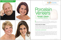 Porcelain Veneers - Dear Doctor Magazine