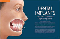 Dental Implants - Dear Doctor Magazine - Winnipeg Manitoba