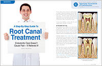 Root Canal - Dear Doctor Magazine