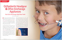 Orthodontic Headgear - Dear Doctor Magazine