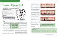 Repairing Chipped Teeth - Dear Doctor Magazine
