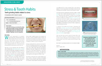 Stress and Tooth Habits - Dear Doctor Magazine