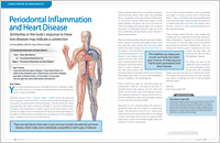Periodontal Disease - Dear Doctor Magazine