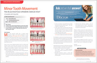 Minor Tooth Movement - Dear Doctor Magazine