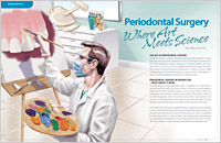 Periodontal (Gum) Surgery - Dear Doctor Magazine