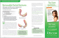 Removable Partial Dentures - Dear Doctor Magazine - Fayetteville NC