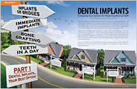 Options for Replacing Teeth - Dear Doctor Magazine