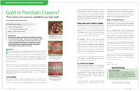 Crowns - Dear Doctor Magazine