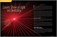 Laser Dentistry Services | Sterling Heights, MI