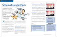 Whitening Traumatized Teeth - Dear Doctor Magazine