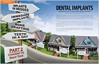 Dental Implants - Dear Doctor Magazine