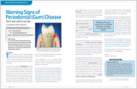 Warning Signs of Periodontal (Gum) Disease - Dear Doctor Magazine