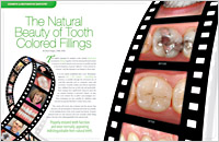 Empastes del color de los dientes-Dear Doctor Magazine