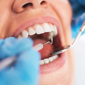 Your Regular Dental Visits Might Change if You’ve had Gum Disease