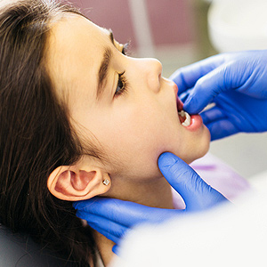 Treating a Child’s Tooth Injury May Require Special Consideration