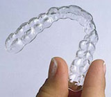 clear aligners.