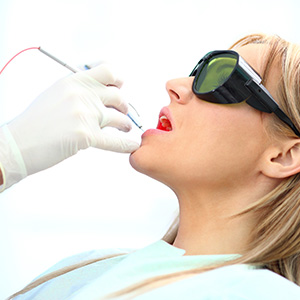 Are Lasers the Future for Treating Advanced Tooth Decay?