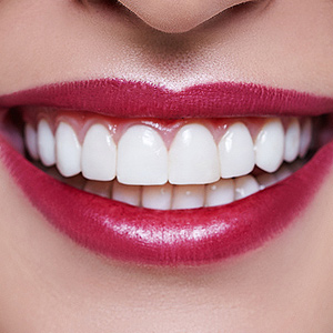Veneers may Offer a Less Invasive Way to Transform Your Smile