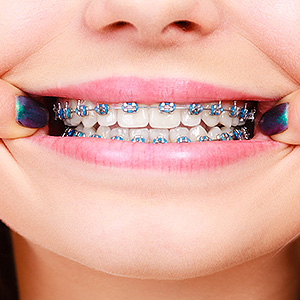 Orthodontics-YourPathtoaMoreAttractiveandHealthierSmile