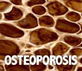 YourOsteoporosisTreatmentCouldAffectYourToothRestorationOptions