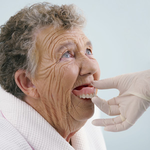 Changes in Bone Structure can Affect Denture Fit