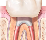 root canals.