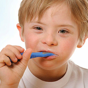 Dental Care of Prime Importance for Children with Special Health Needs